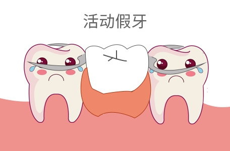 做一颗假牙齿多少钱啊